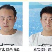 黄氏林林假发